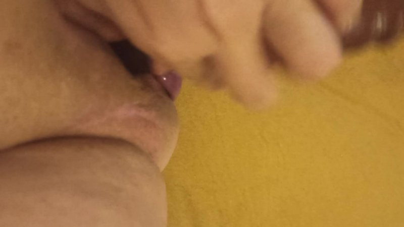 umbilical hernia adult symptom with Hanna_Deh — adult tube video
